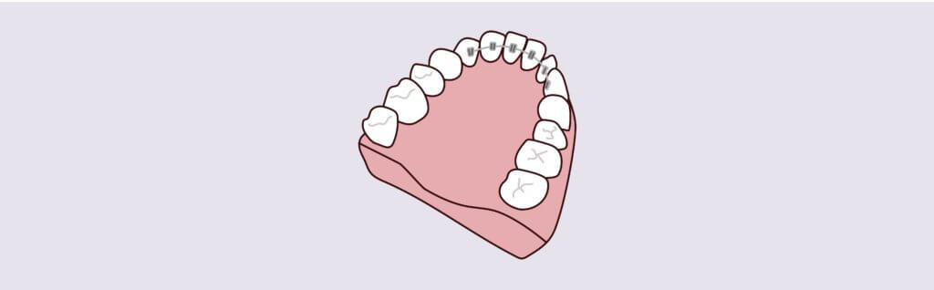 Dreamscape Imagery 09 1024x318 1 - Lombardo & Cho Dentistry