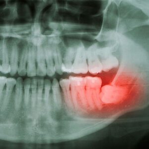 dentist near me oral surgery