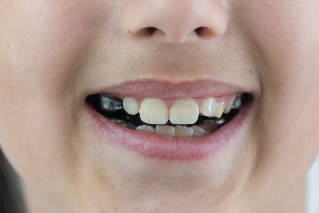 AdobeStock 523241649 - Lombardo & Cho Dentistry