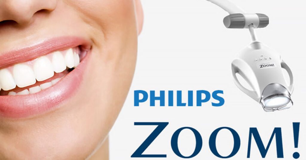 zoom whitening - Lombardo & Cho Dentistry