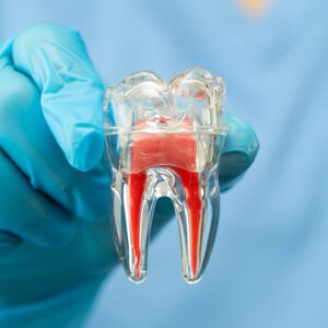 endodontist Twentynine Palms root canals