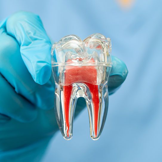 endodontist Twentynine Palms root canals